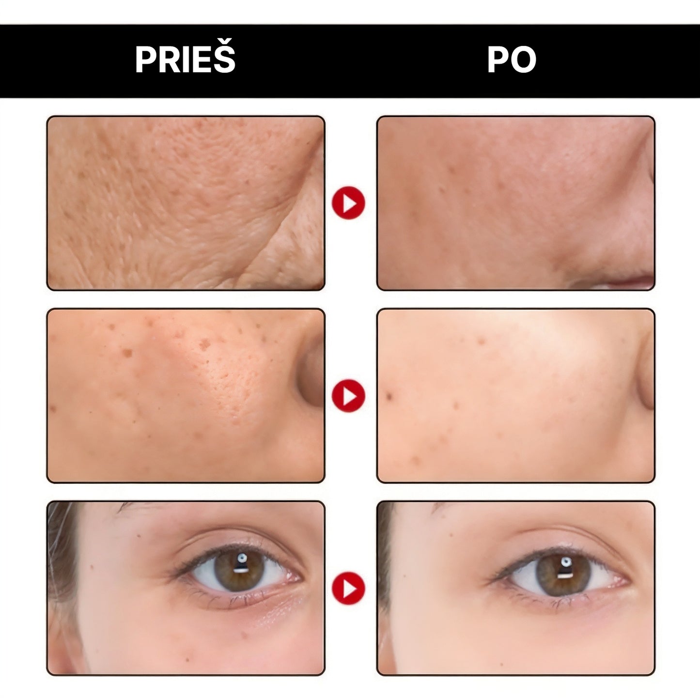 DermaPure – Jauninantis serumas | Suteik jaunystę savo odai - BaltijosGrozis.com