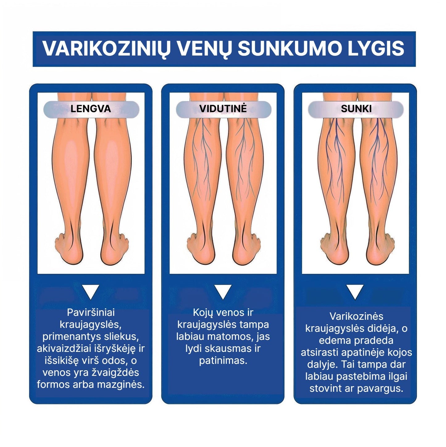 VarikoStop - Varikozinių venų kremas | Sustabdyk varikozę kol ji tau nesugadino gyvenimo - BaltijosGrozis.com