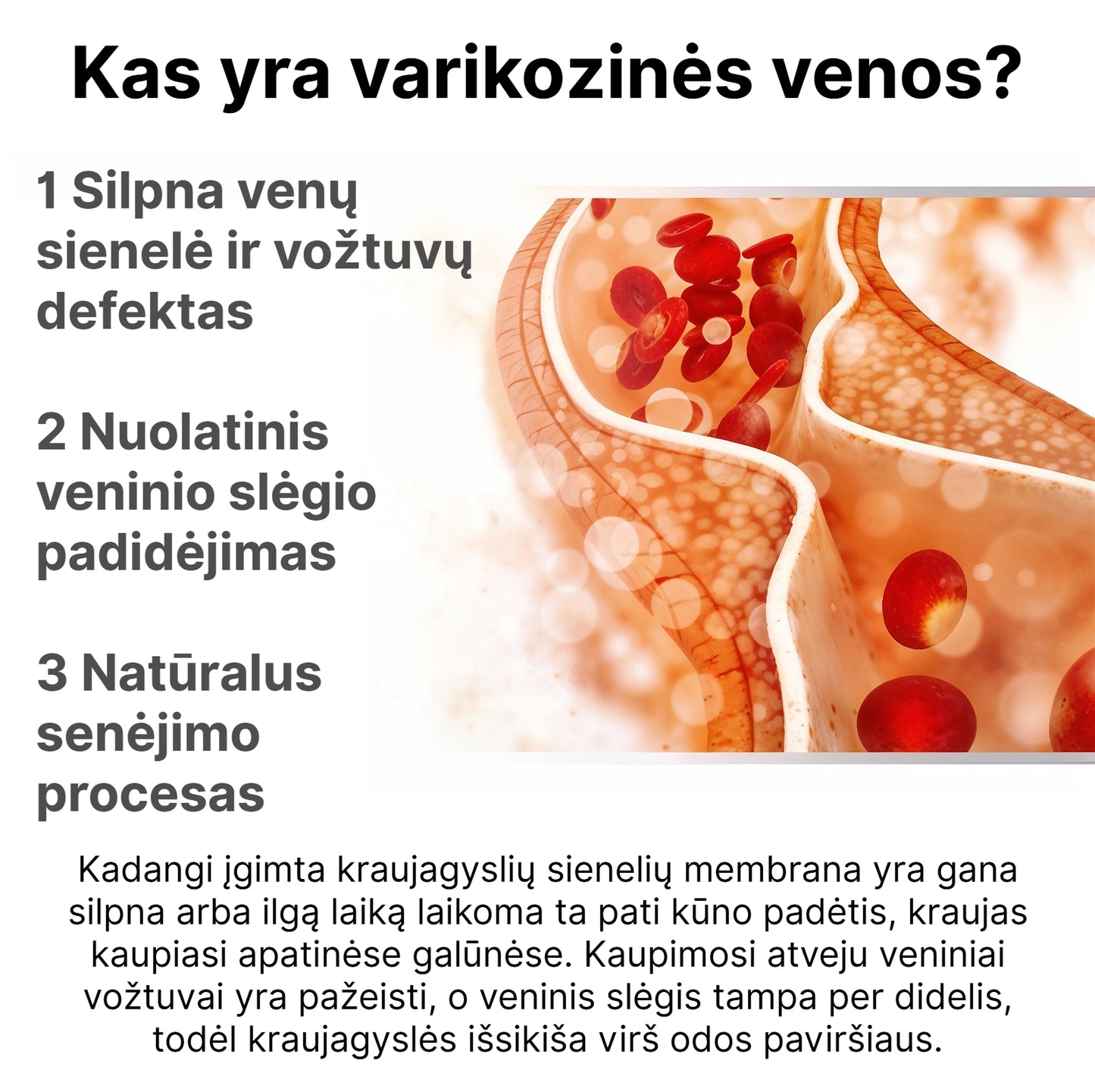 VarikoStop - Varikozinių venų kremas | Sustabdyk varikozę kol ji tau nesugadino gyvenimo - BaltijosGrozis.com