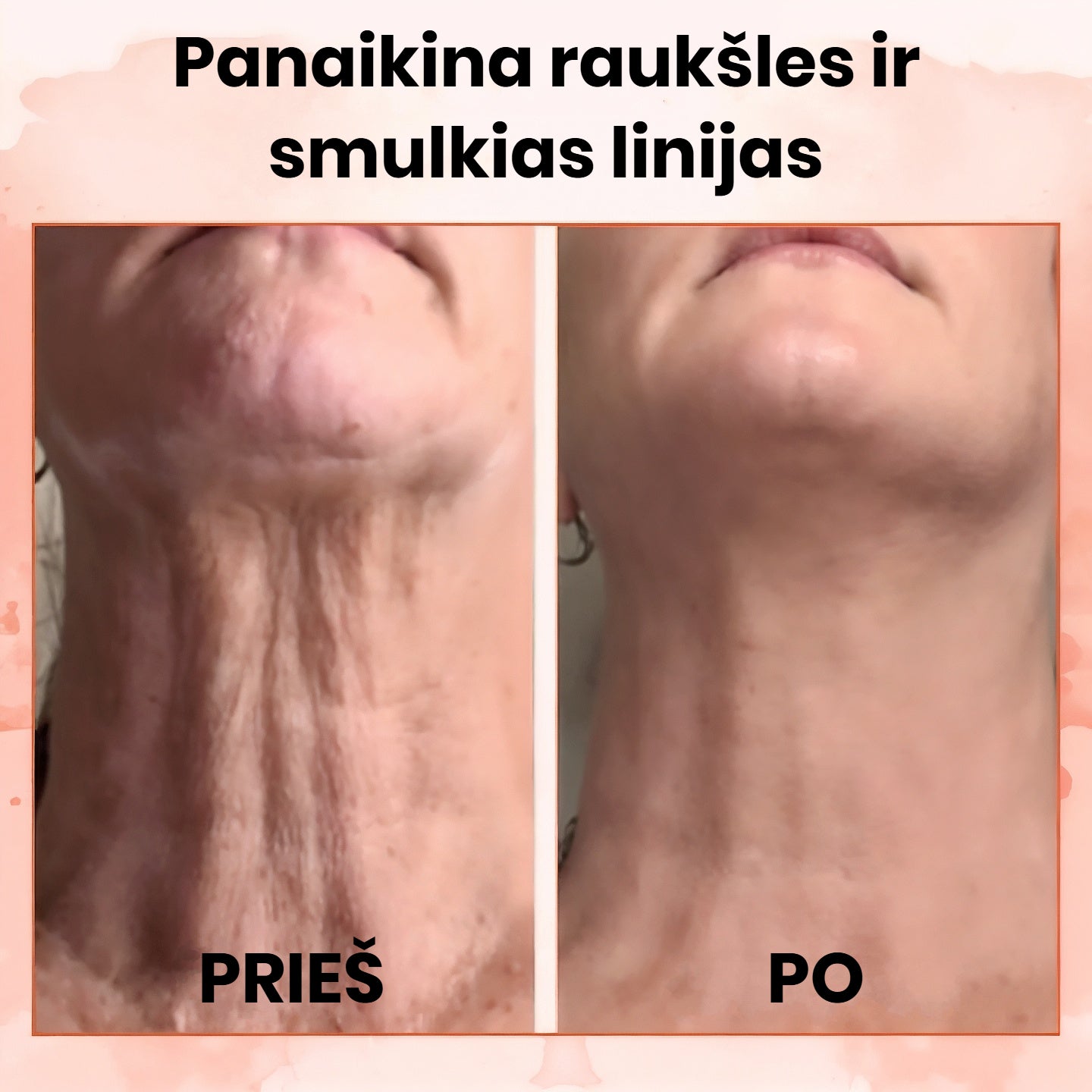 Perlie - Prabangus Atjauninantis Kremas | Akimirksniu lygesnė, jauniau atrodanti oda - BaltijosGrozis.com