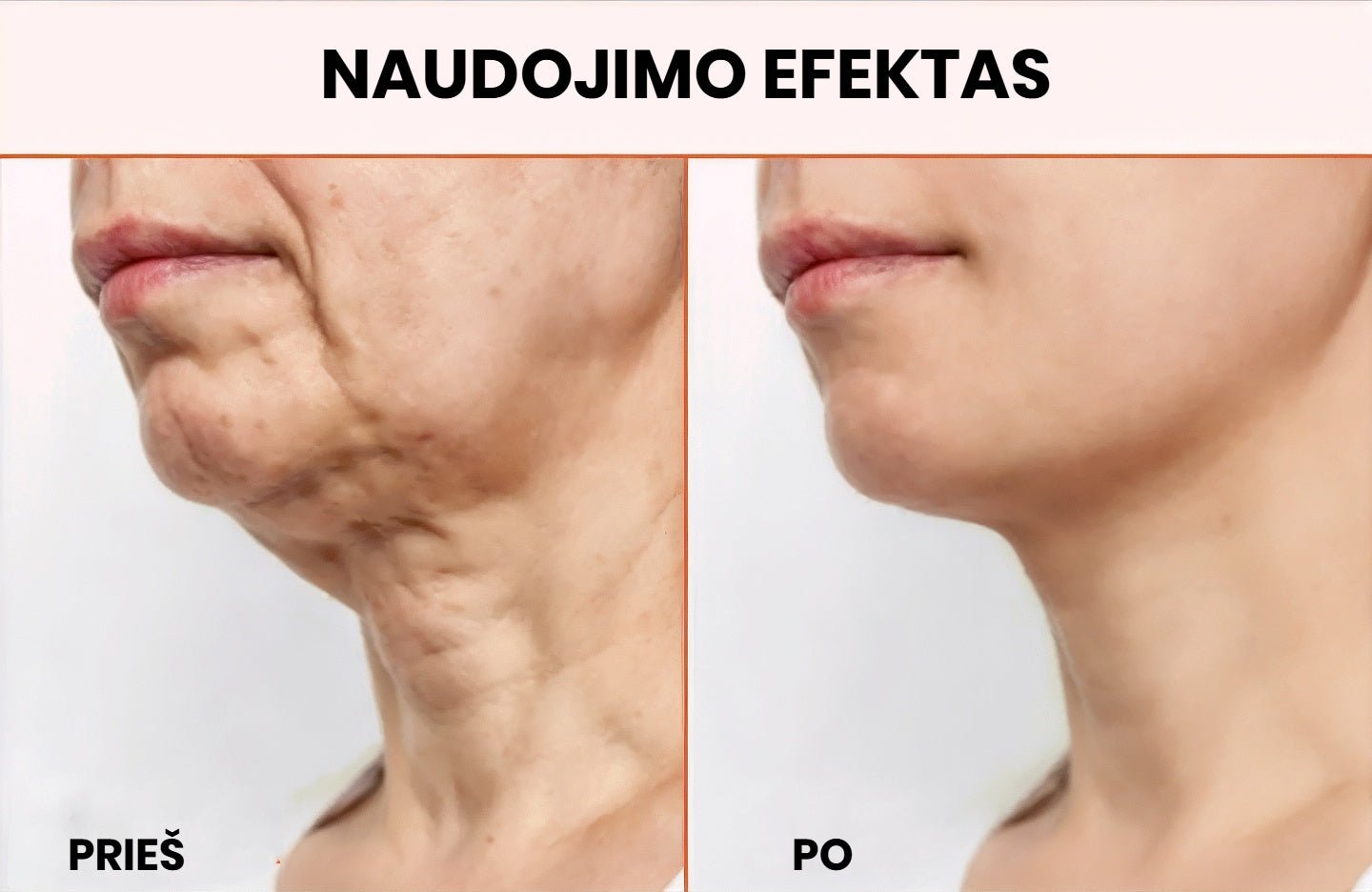 Perlie - Prabangus Atjauninantis Kremas | Akimirksniu lygesnė, jauniau atrodanti oda - BaltijosGrozis.com