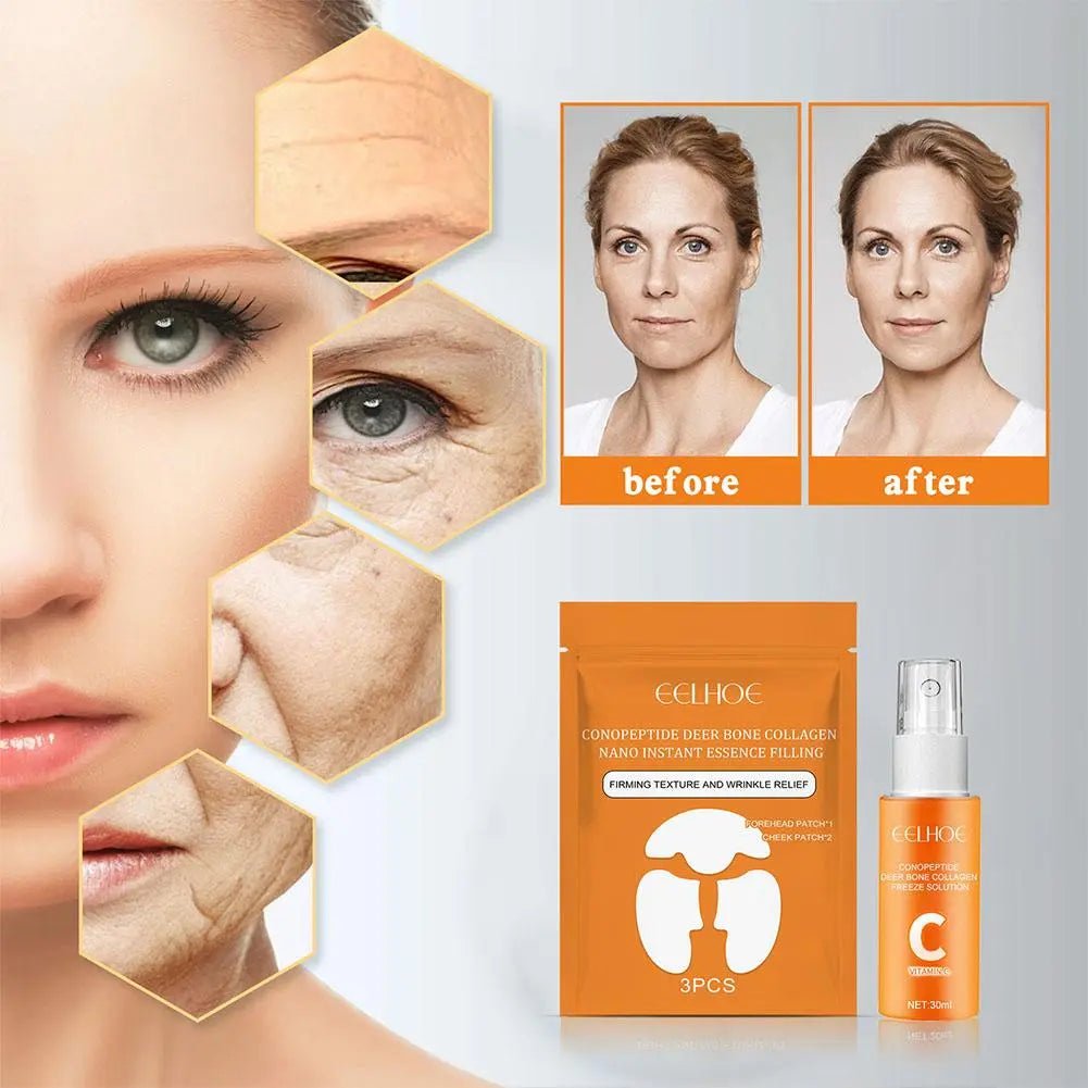 Goldbotox kaukių rinkinys ir nemokamai SPRAY VITAC - TIK ŠIANDIEN. - BaltijosGrozis.com