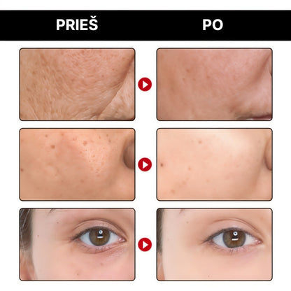 DermaPure – Jauninantis serumas | Suteik jaunystę savo odai - BaltijosGrozis.com