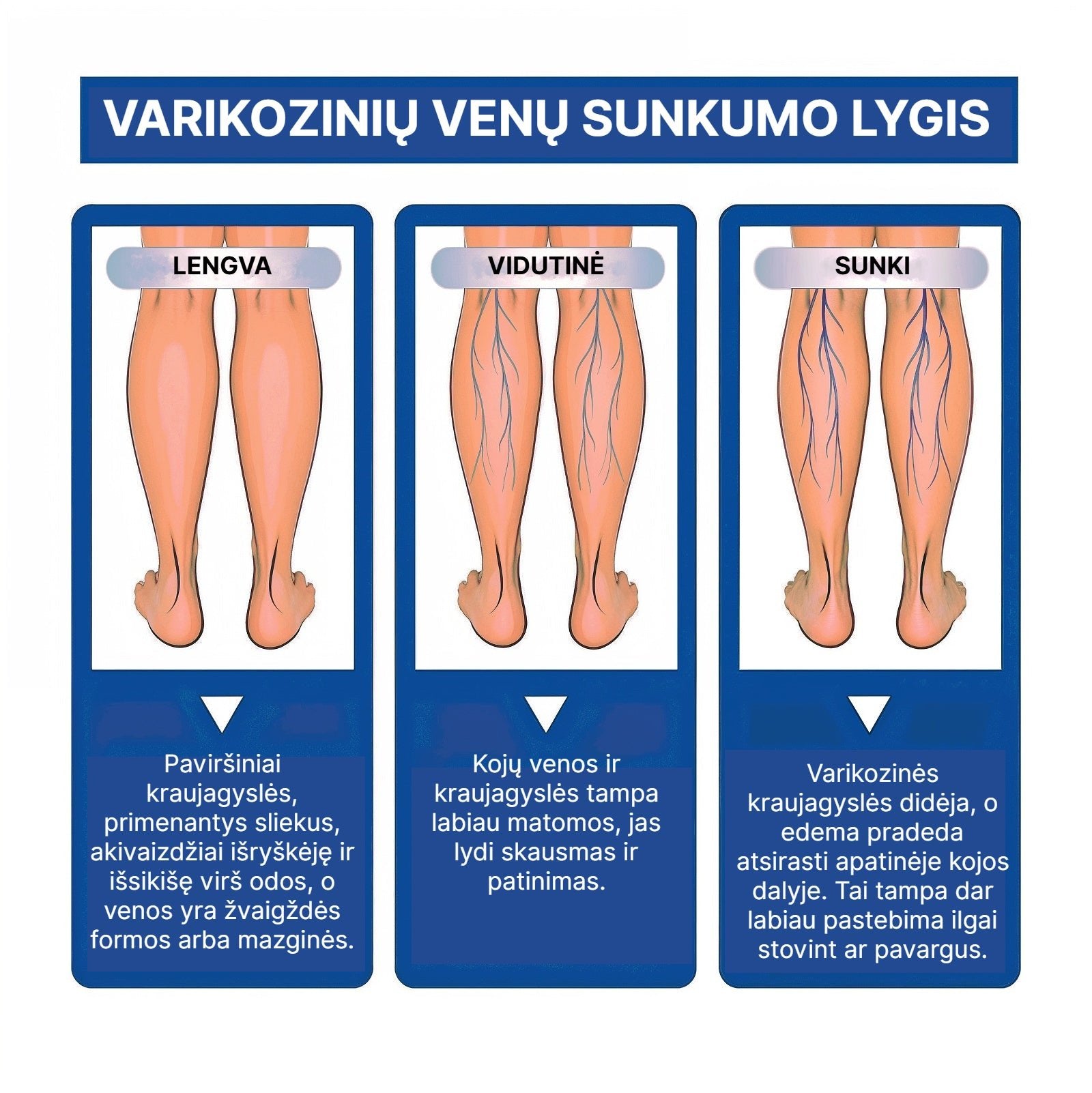 VarikoStop - Varikozinių venų kremas | Sustabdyk varikozę kol ji tau nesugadino gyvenimo - BaltijosGrozis.com