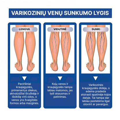 VarikoStop - Varikozinių venų kremas | Sustabdyk varikozę kol ji tau nesugadino gyvenimo - BaltijosGrozis.com