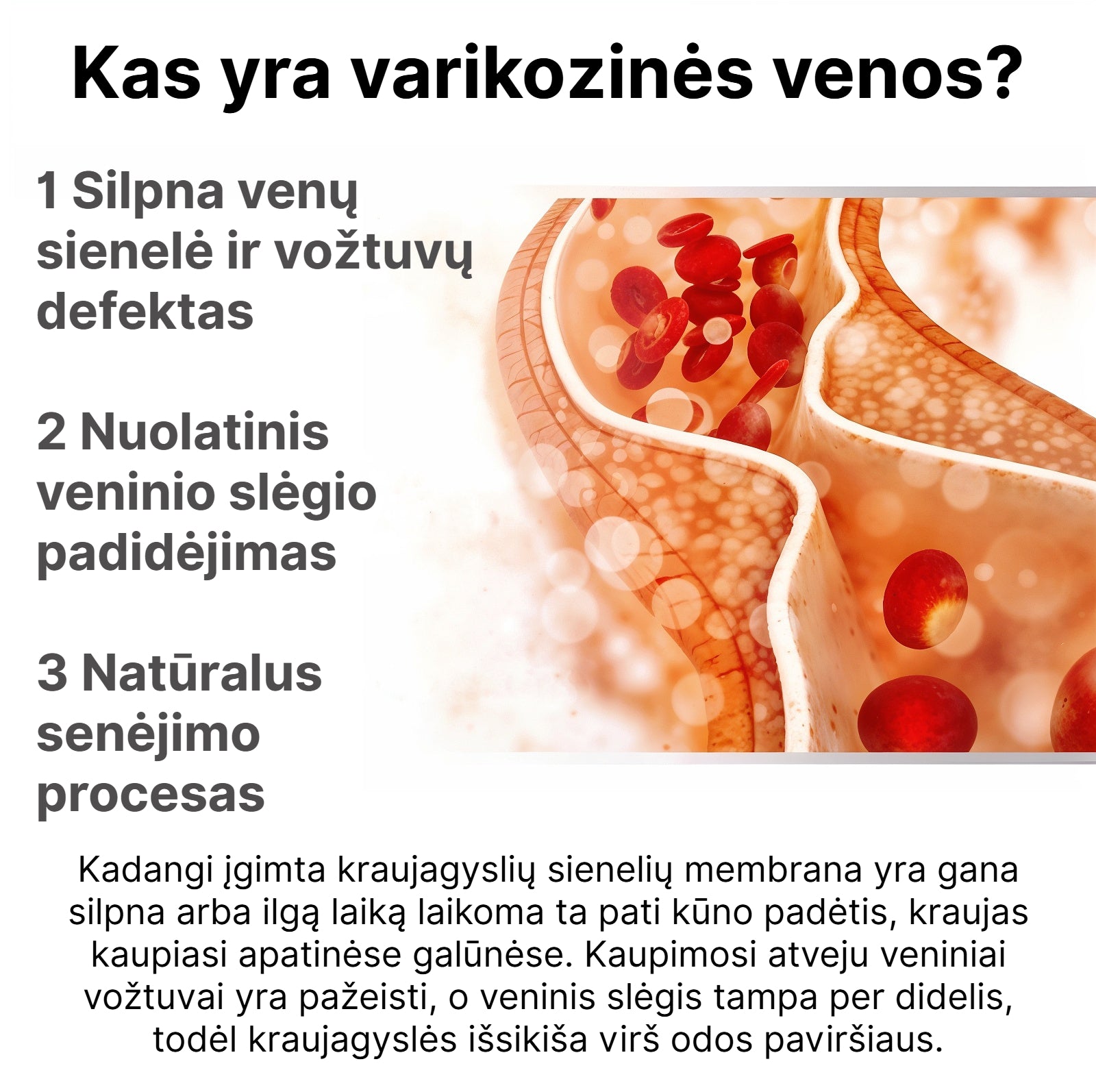 VarikoStop - Varikozinių venų kremas | Sustabdyk varikozę kol ji tau nesugadino gyvenimo - BaltijosGrozis.com