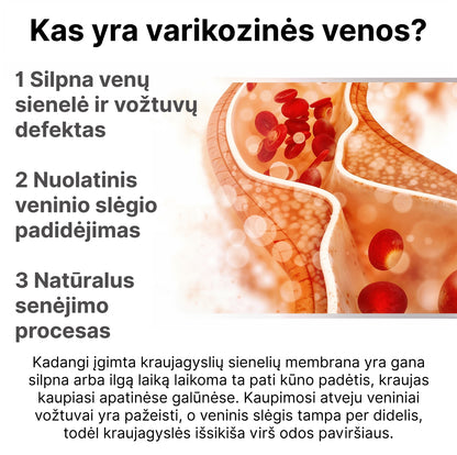 VarikoStop - Varikozinių venų kremas | Sustabdyk varikozę kol ji tau nesugadino gyvenimo - BaltijosGrozis.com