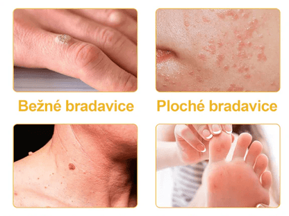 Turonu™ Kremas gydymui su bičių nuodais - BaltijosGrozis.com