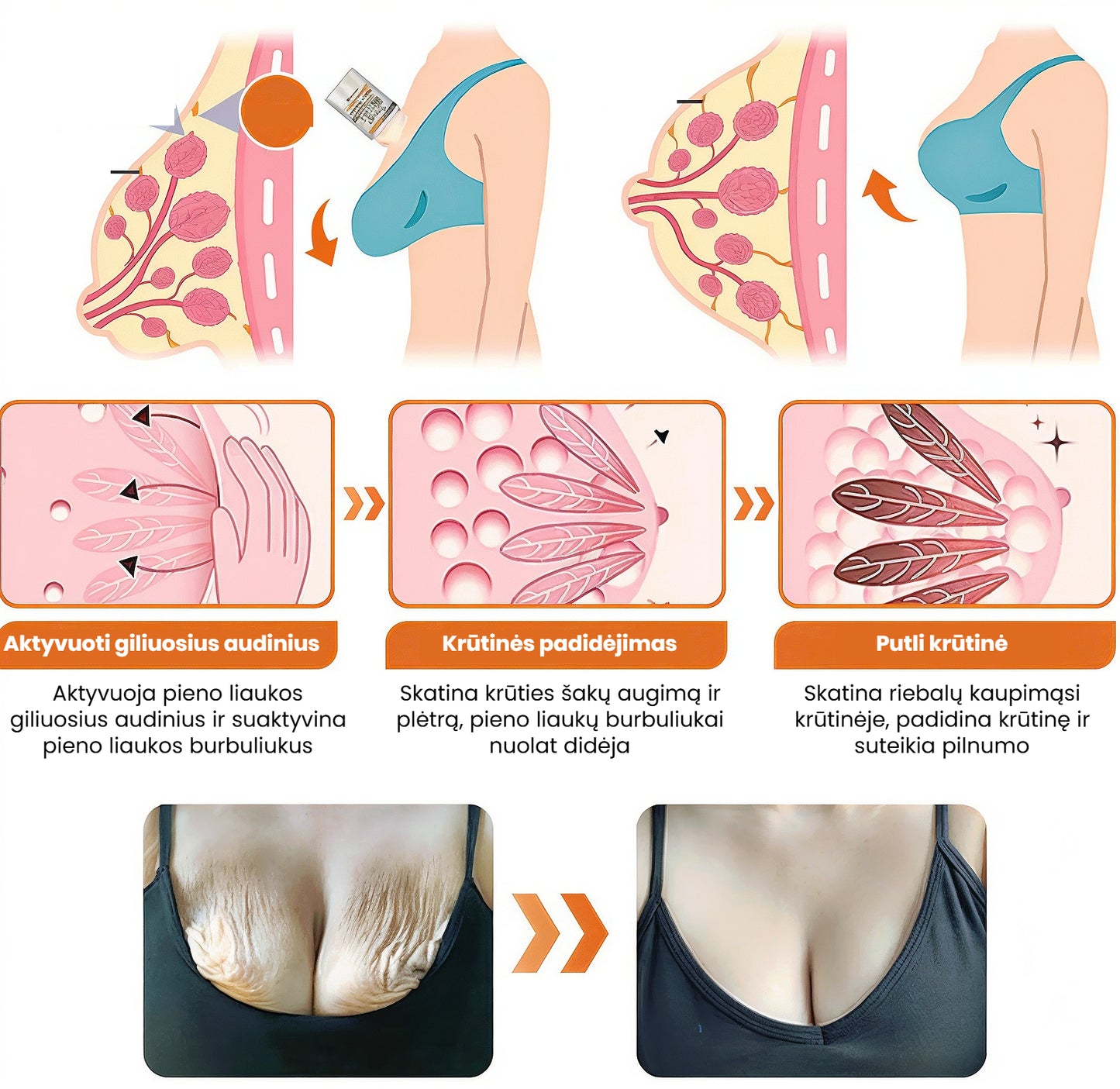 Dermavie - Stangrinantis kūno kremas su botulinu | Atrodysite puikiai akimirksniu - BaltijosGrozis.com