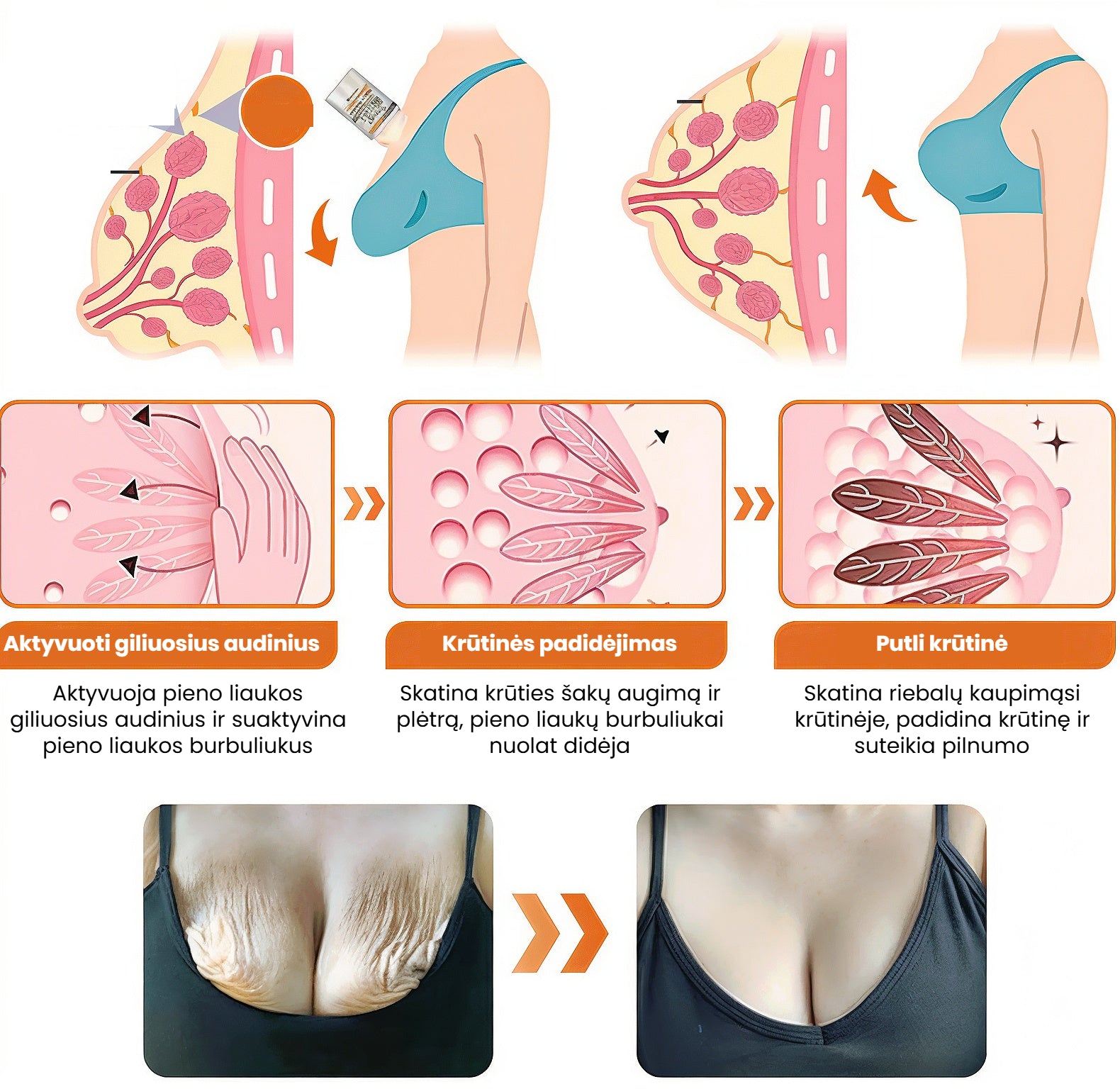 Dermavie - Stangrinantis kūno kremas su botulinu | Atrodysite puikiai akimirksniu - BaltijosGrozis.com