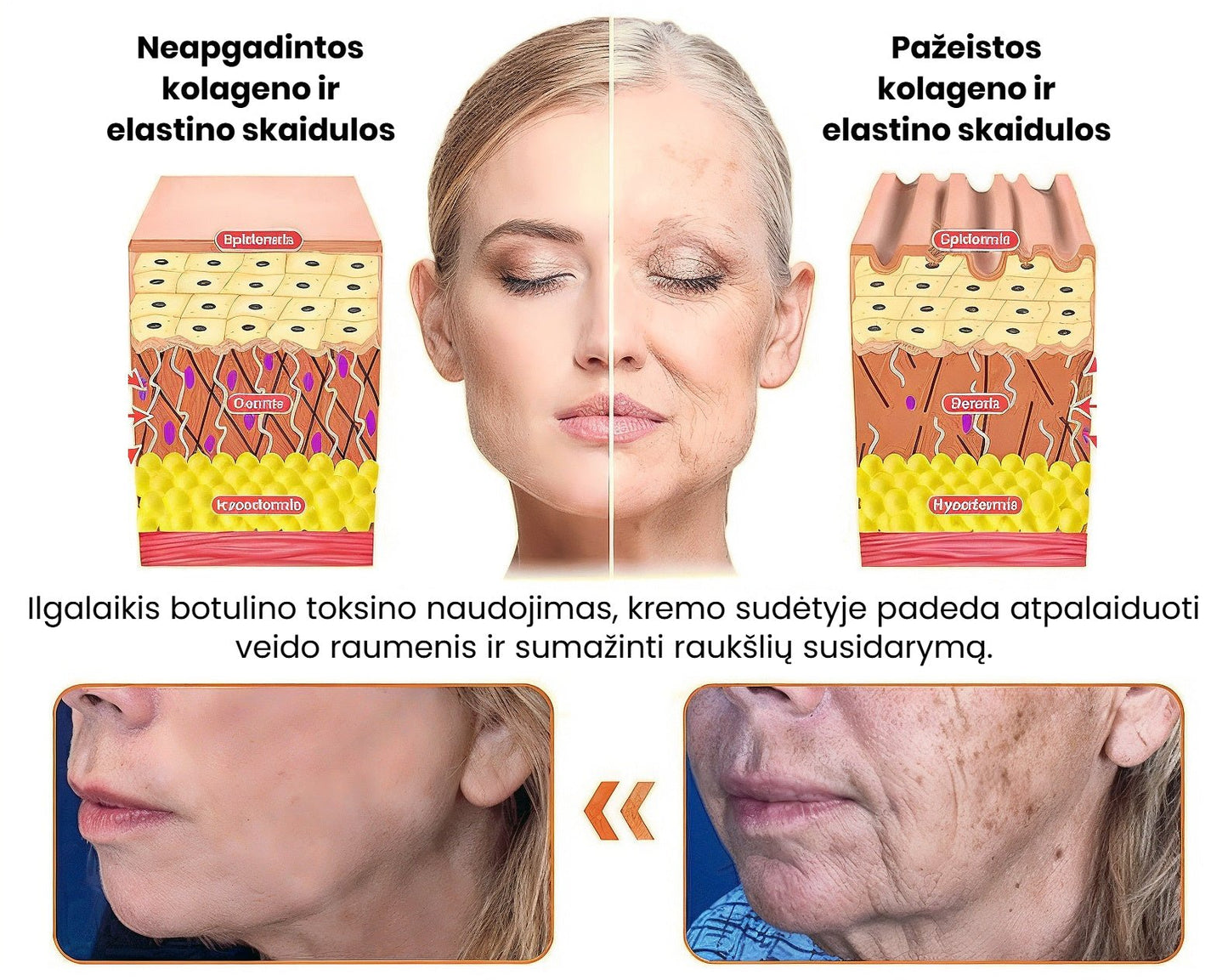 Dermavie - Stangrinantis kūno kremas su botulinu | Atrodysite puikiai akimirksniu - BaltijosGrozis.com