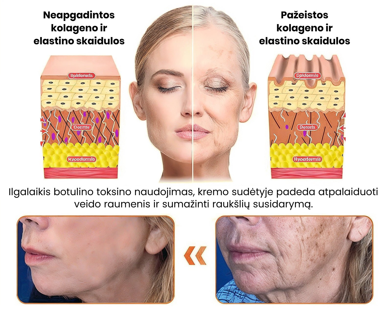Dermavie - Stangrinantis kūno kremas su botulinu | Atrodysite puikiai akimirksniu - BaltijosGrozis.com