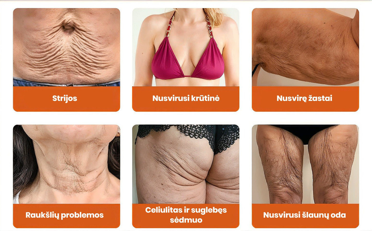 Dermavie - Stangrinantis kūno kremas su botulinu | Atrodysite puikiai akimirksniu - BaltijosGrozis.com