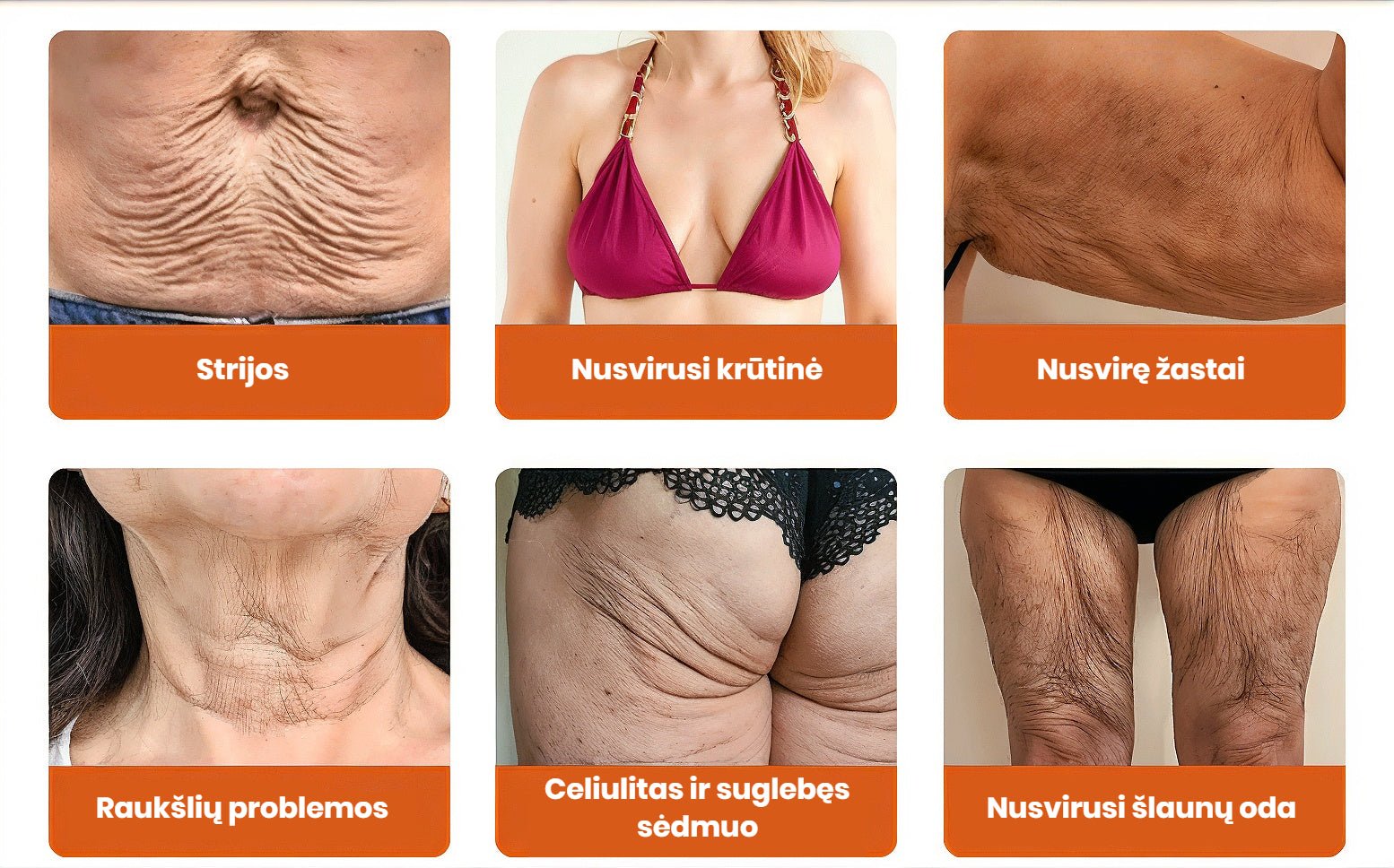Dermavie - Stangrinantis kūno kremas su botulinu | Atrodysite puikiai akimirksniu - BaltijosGrozis.com